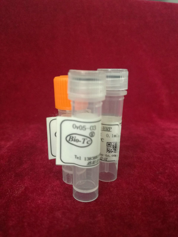 羊抗-铁蛋白,IgG