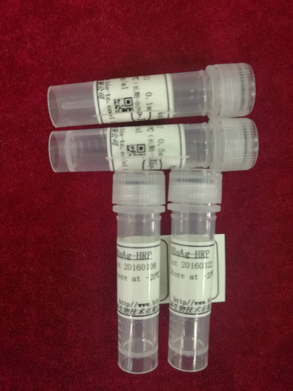 兔抗-正常人,HRP标记