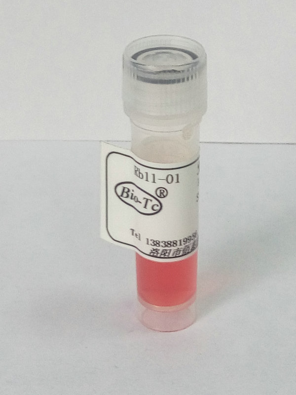 兔抗-正常人,血清